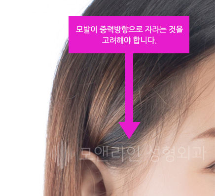 모발이 중력방향으로 자라는 것을 고려해야 합니다.