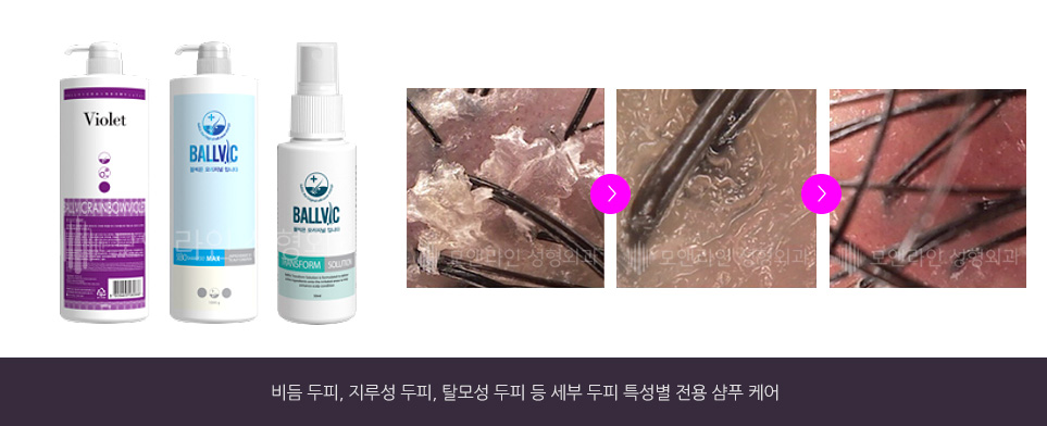 비듬 두피, 지루성 두피, 탈모성 두피 등 세부 두피 특성별 전용 샴푸 케어