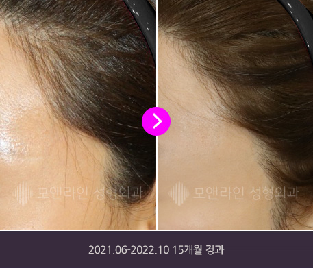 2021.06-2022.10 15개월 경과