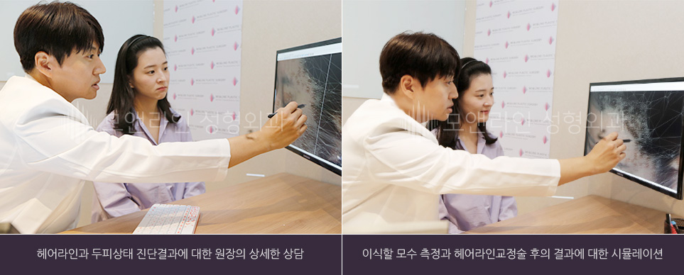 헤어라인과 두피상태 진단결과에 대한 원장의 상세한 상담 / 이식할 모수 측정과 헤어라인교정술 후의 결과에 대한 시뮬레이션 데이터 제