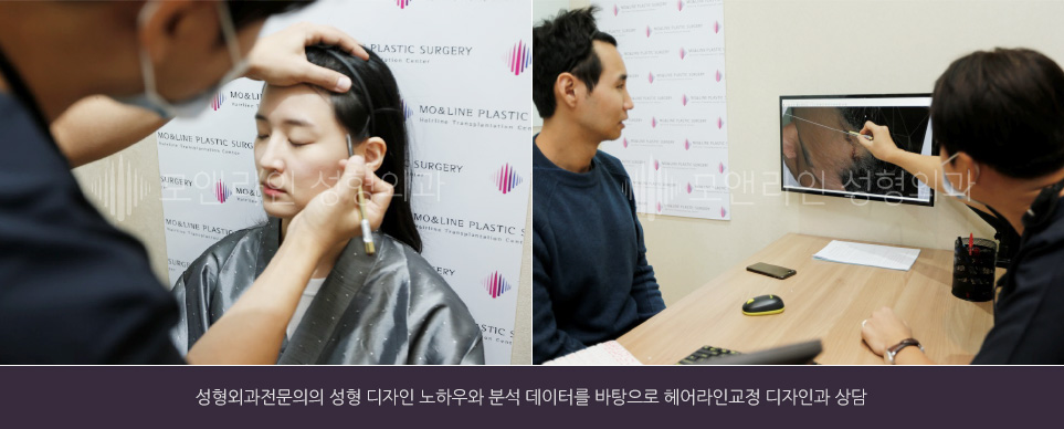성형외과전문의의 성형 디자인 노하우와 분석 데이터를 바탕으로 헤어라인교정 디자인과 상담
