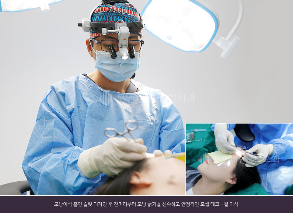 모낭이식 홀인 슬릿 디자인 후 잔머리부터 모낭 굵기별 신속하고 안정적인 포셉 테크니컬 이식