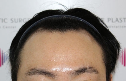 치료후기 이미지