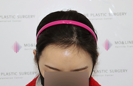 치료후기 이미지