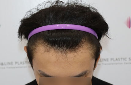 치료후기 이미지