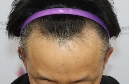 치료후기 이미지