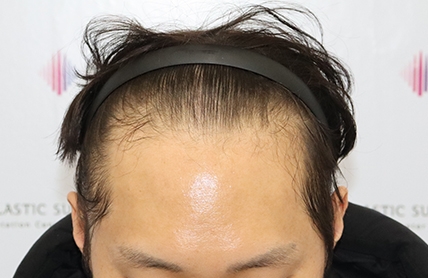 치료후기 이미지