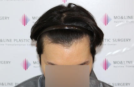 치료후기 이미지