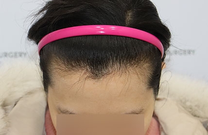 치료후기 이미지
