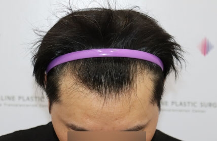 치료후기 이미지