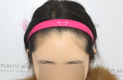 치료후기 이미지
