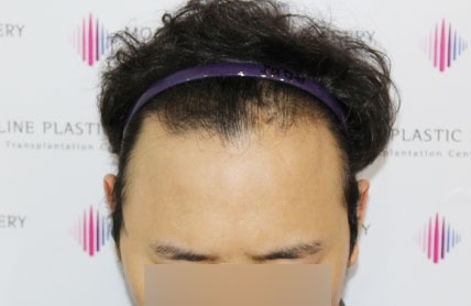 치료후기 이미지
