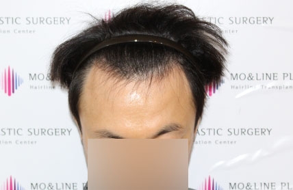 치료후기 이미지