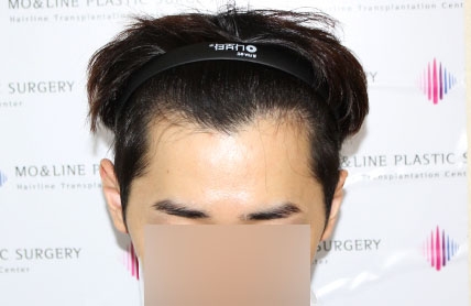 치료후기 이미지