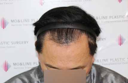 치료후기 이미지