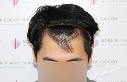 치료후기 이미지