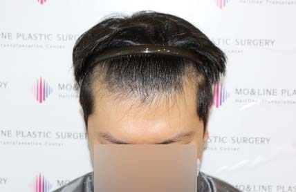 치료후기 이미지
