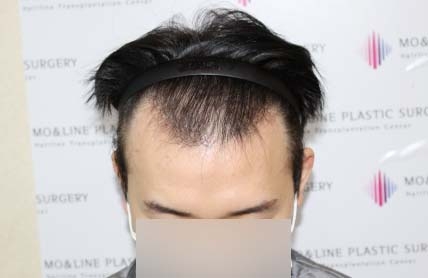 치료후기 이미지