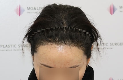 치료후기 이미지