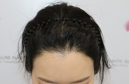 치료후기 이미지