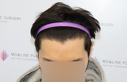치료후기 이미지
