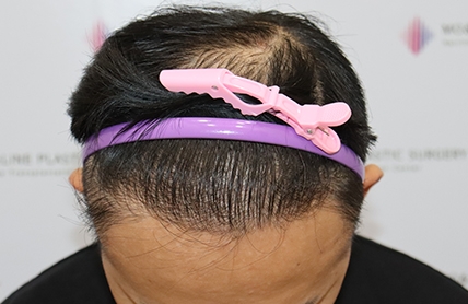 치료후기 이미지