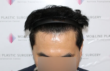 치료후기 이미지