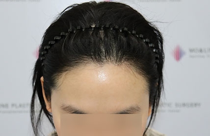 치료후기 이미지
