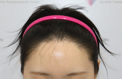 치료후기 이미지