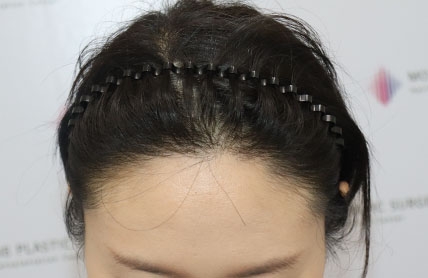치료후기 이미지