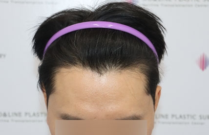 치료후기 이미지
