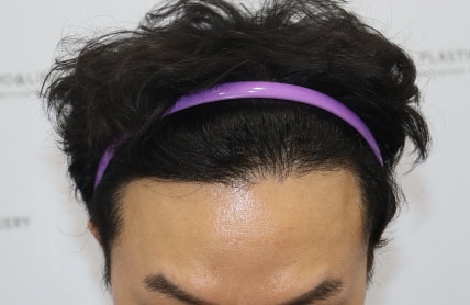 치료후기 이미지