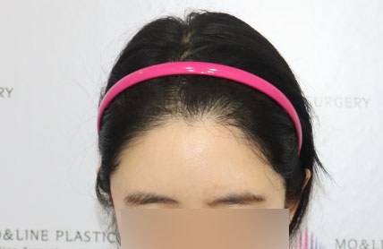 치료후기 이미지