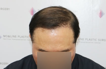 치료후기 이미지