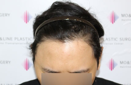 치료후기 이미지