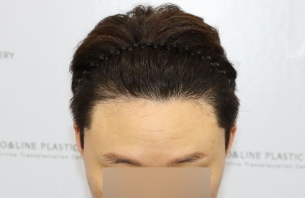 치료후기 이미지