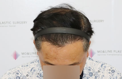 치료후기 이미지