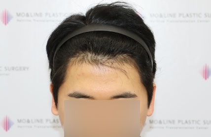 치료후기 이미지
