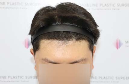 치료후기 이미지