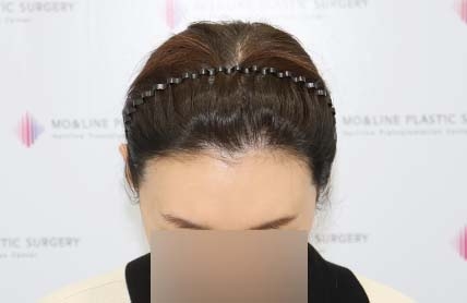 치료후기 이미지