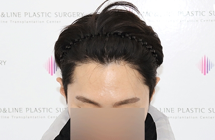 치료후기 이미지