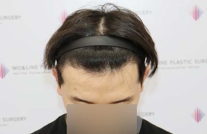 치료후기 이미지