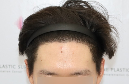 치료후기 이미지