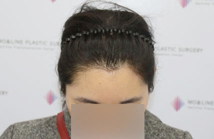 치료후기 이미지