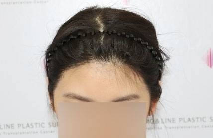 치료후기 이미지