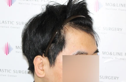 치료후기 이미지