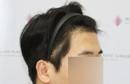치료후기 이미지