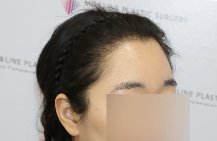 치료후기 이미지