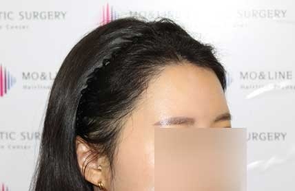 치료후기 이미지