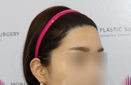 치료후기 이미지